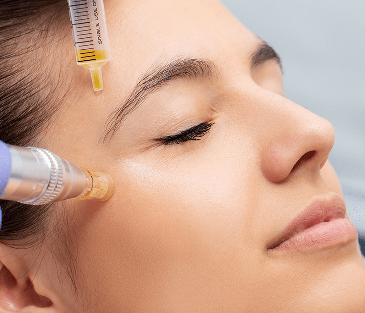 Woman receiving a facial treatment with a syringe and a device.